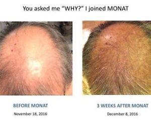 Monat hair regrowth Products FLASH SALE!!!