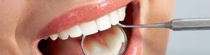 Painless Tooth Extraction at Mer Bleue Dental Centre Orleans SERVICES