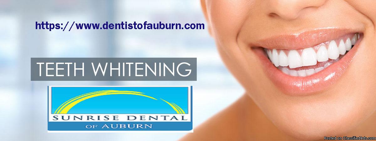Teeth Whitening Auburn | Cosmetic Dentistry | Sunrise Dental