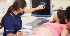 Best Pregnancy Ultrasound in Toronto