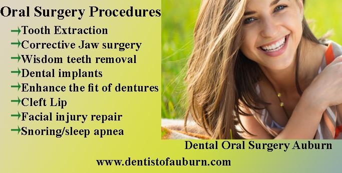 Dental Oral Surgery Auburn | All on 4 dental implants Auburn