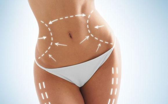 Want the Results of Liposuction Without the Surgery in