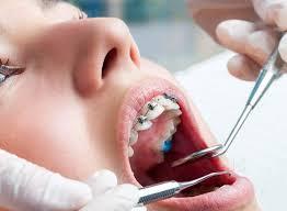 Best Dental Implant Surgeon Bellevue