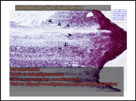 Histopathology slides